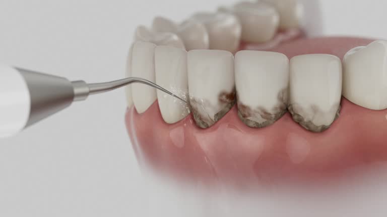 Reliable Dental Implants contractor in Desert Hills, AZ by Smile Center Dentistry